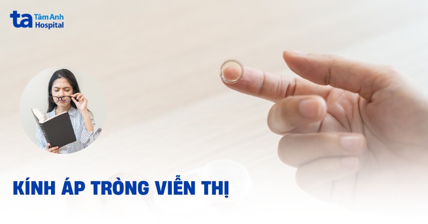 Kính áp tròng viễn thị: Phân loại, ưu nhược điểm và cách sử dụng