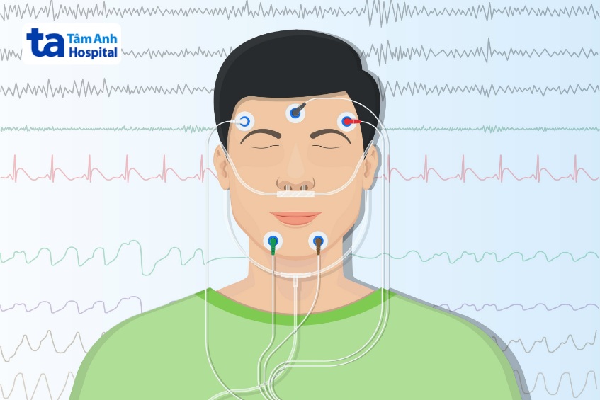 kỹ thuật đo đa ký giấc ngủ chẩn đoán vấn đề giấc ngủ