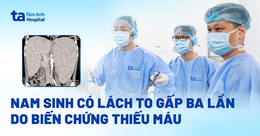 lách to gấp 3 lần