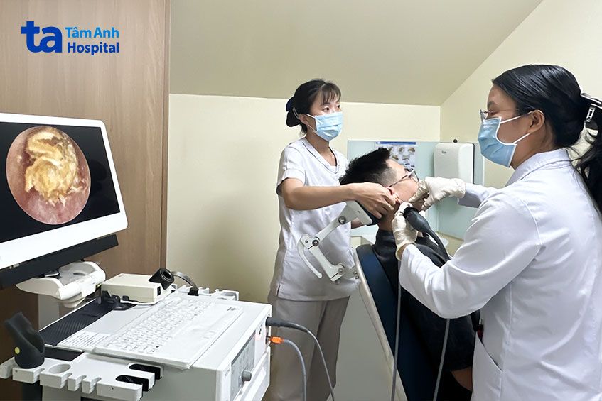 lấy ráy tai qua nội soi