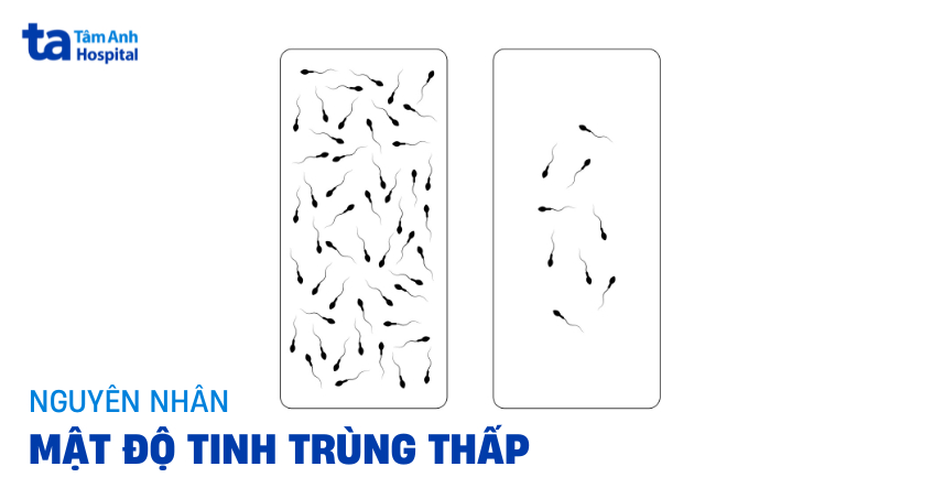 Mật độ tinh trùng thấp nguyên nhân do đâu? Cảnh báo điều gì?