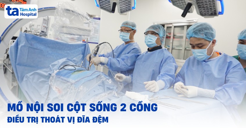 Mổ nội soi cột sống hai cổng điều trị thoát vị đĩa đệm có tốt không?