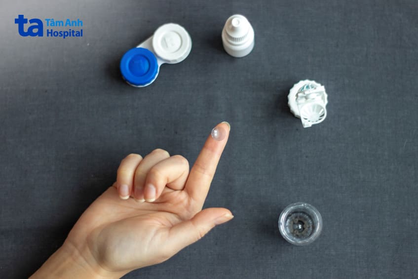 một loại kính áp tròng đặt trực tiếp vào mắt