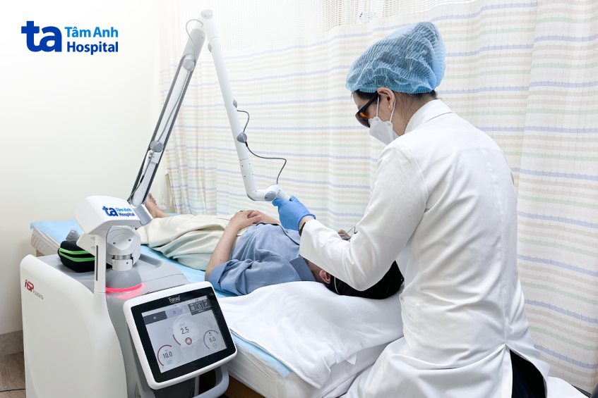 người bệnh được bắn laser pico xóa thâm mụn