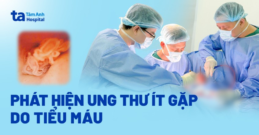 phát hiện ung thư ít gặp do tiểu máu