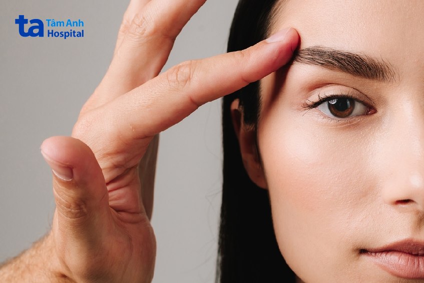 phẫu thuật điều trị sụp mí mắc phải