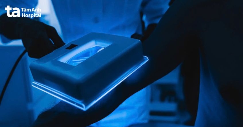 phương pháp kiểm tra dưới đèn cực tím