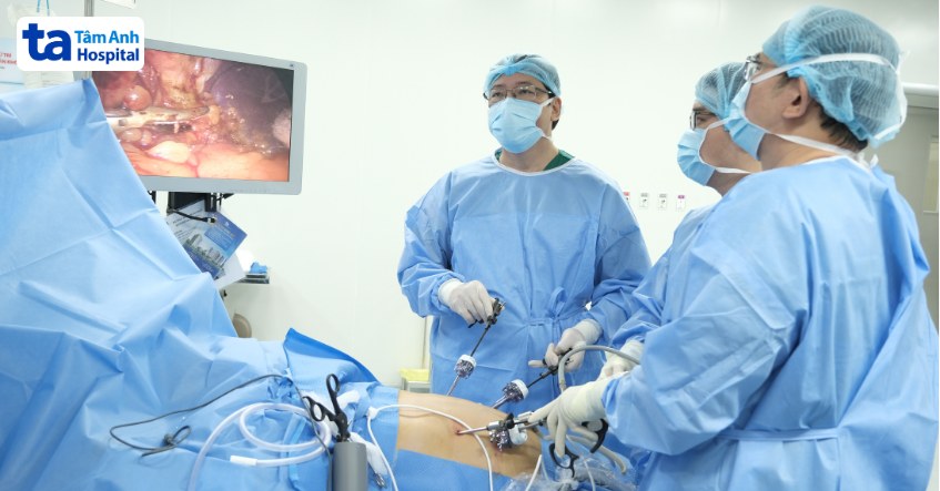 quy trình cắt gist dạ dày