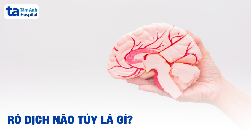 rò dịch não tủy