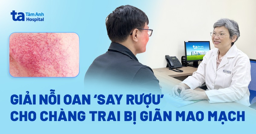 say ruọu giãn mao mạch