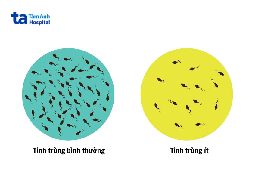so sánh tinh trùng bình thường và tinh trùng ít