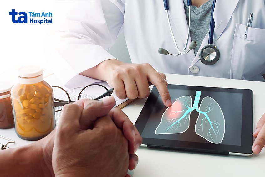 thời gian điều trị tràn khí màng phổi