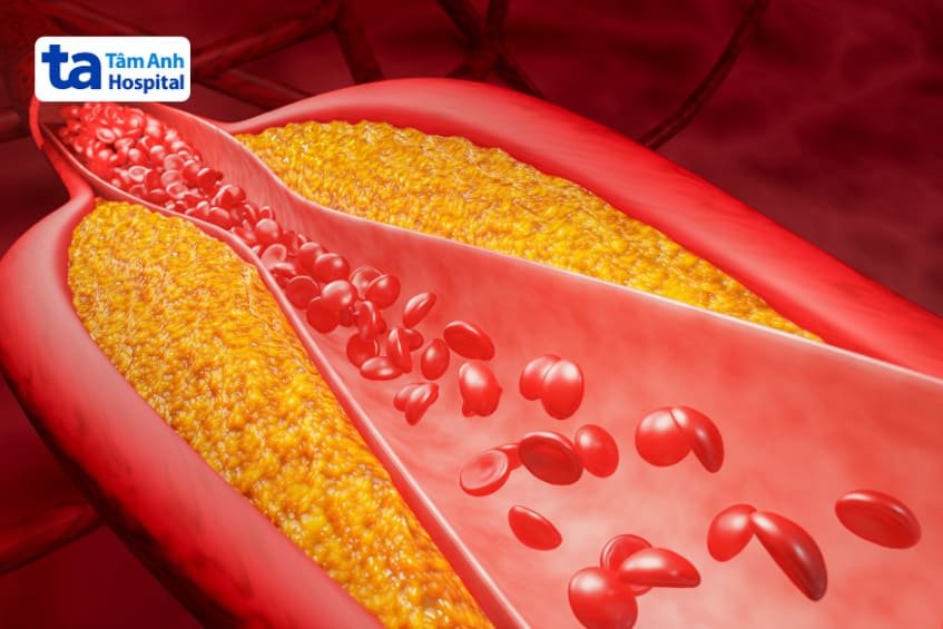 thuốc sezstad dùng điều trị tăng cholesterol máu