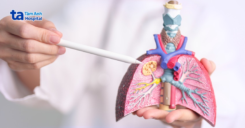 thuỳ phổi phải có 3 thùy