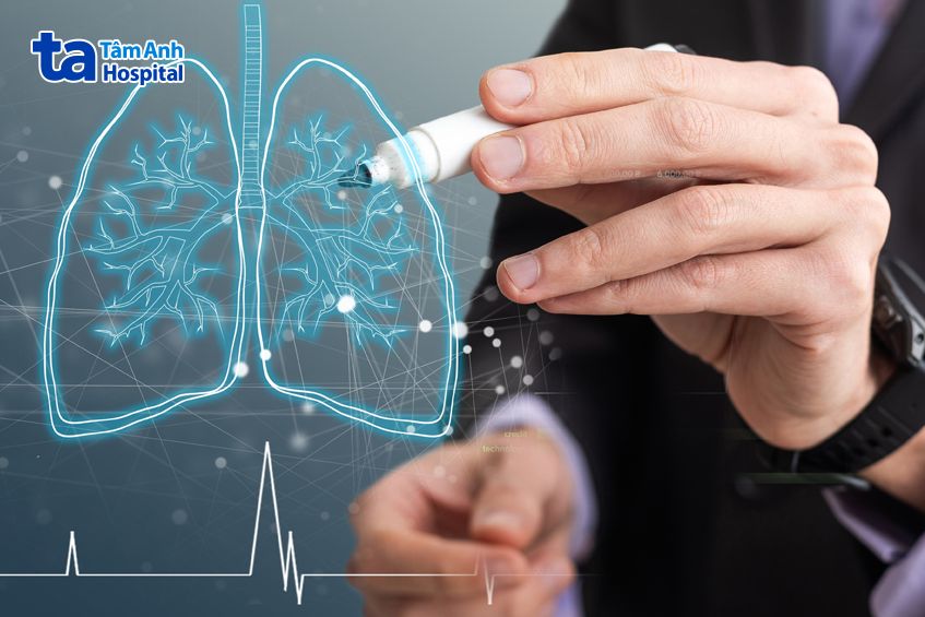 thuỳ trên phổi trái nằm phía trên khe chéo