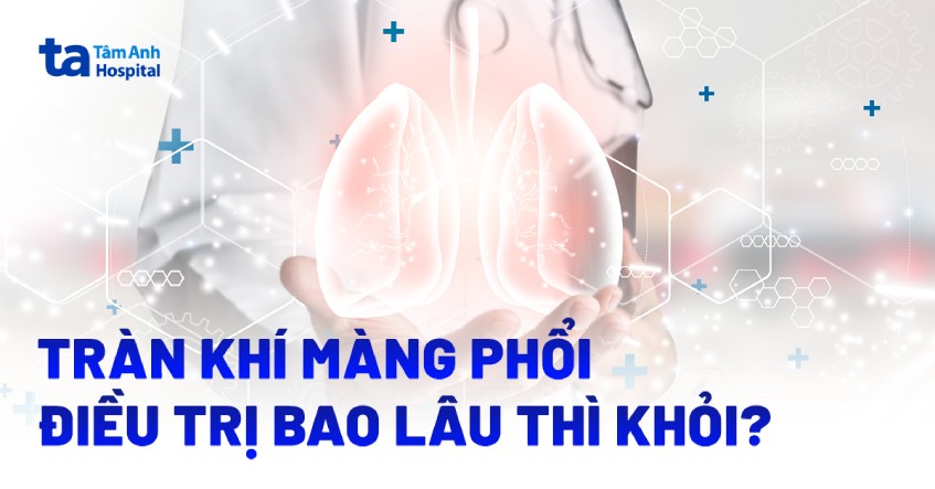 Tràn khí màng phổi điều trị bao lâu thì khỏi? Yếu tố tác động