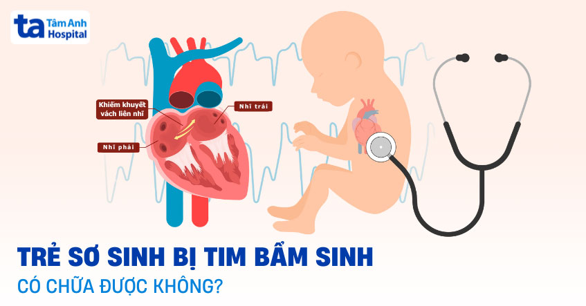 Trẻ sơ sinh bị tim bẩm sinh có chữa được không? Có khỏi hẳn không?