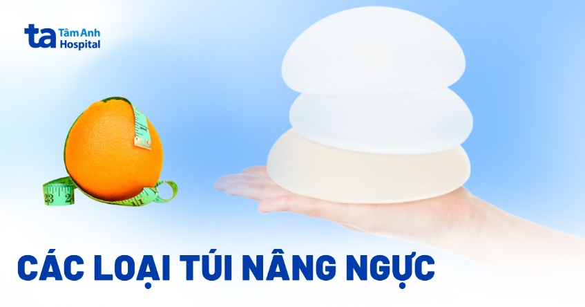 Các loại túi ngực hiện nay: Đặc điểm và lưu ý khi nâng ngực