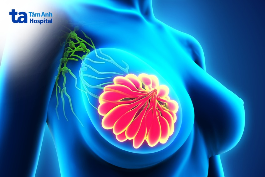 u xơ vú kích thước bao nhiêu phải mổ