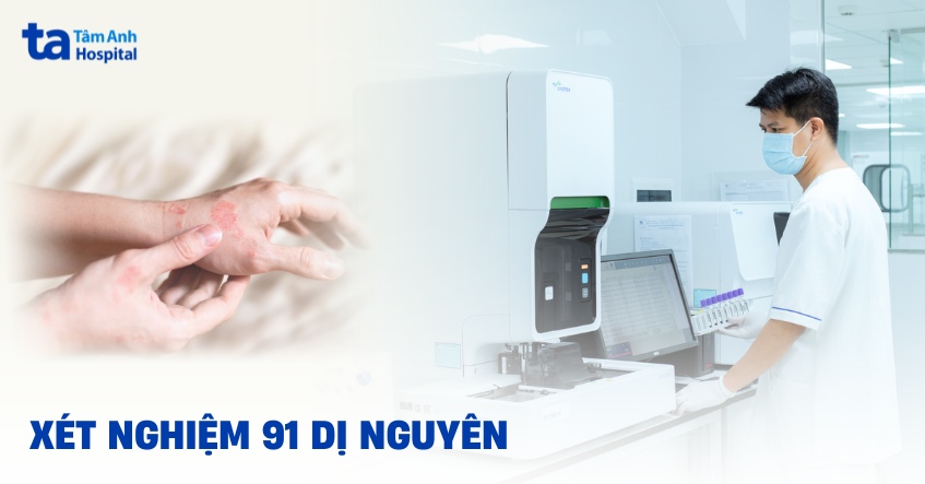Xét nghiệm 91 dị nguyên bao nhiêu tiền? Ở đâu nhanh và chính xác?
