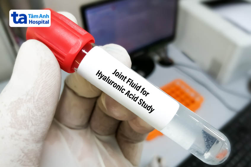 Xét nghiệm tìm nguyên nhân gây đau khớp háng về đêm