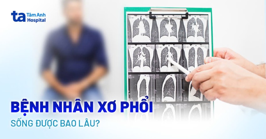 Xơ phổi sống được bao lâu? Yếu tố ảnh hưởng đến tuổi thọ
