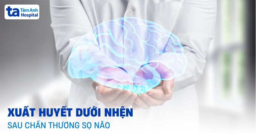 Xuất huyết dưới nhện sau chấn thương sọ não có chữa được không?