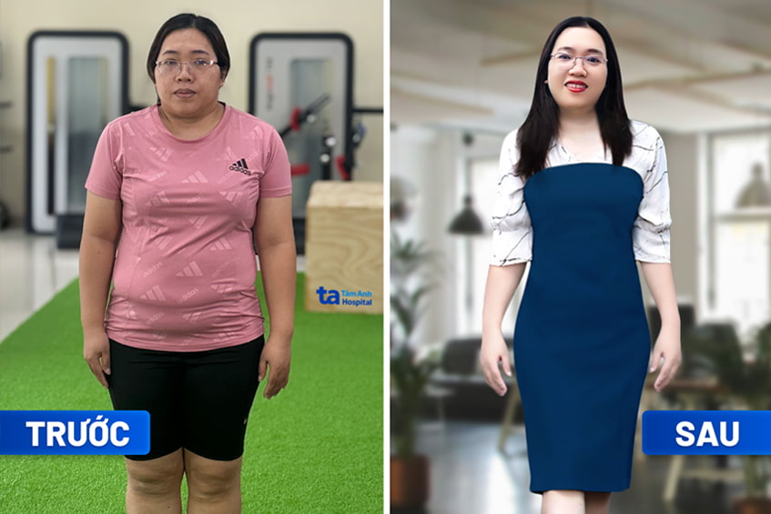 Chị Phạm Thị Ánh Dương giảm 7kg trong 3 tháng tại Tâm Anh. Chị không thấy mệt, không mất sức, không kiêng ăn quá mức, không bị stress