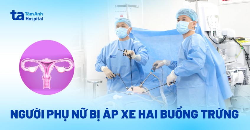 áp xe nang lạc nội mạc tử cung ở 2 buồng trứng