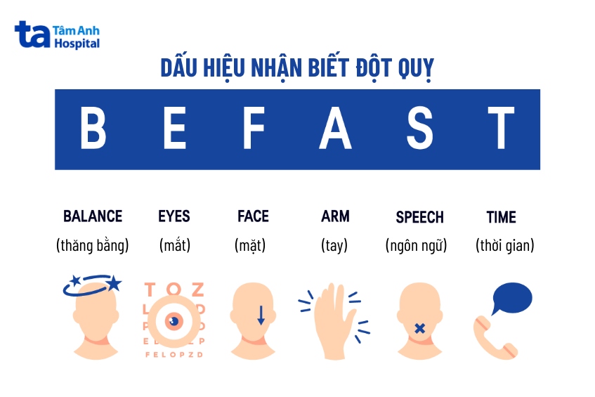 be fast trong đột quỵ
