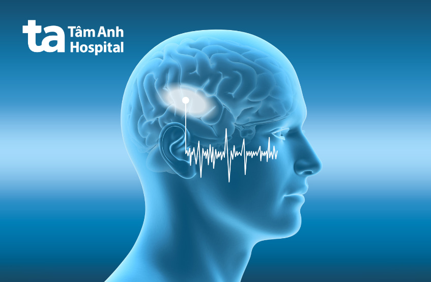 Điếc đột ngột là gì?