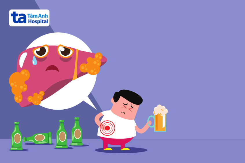 Hậu quả của việc uống bia đối với người mắc bệnh gan