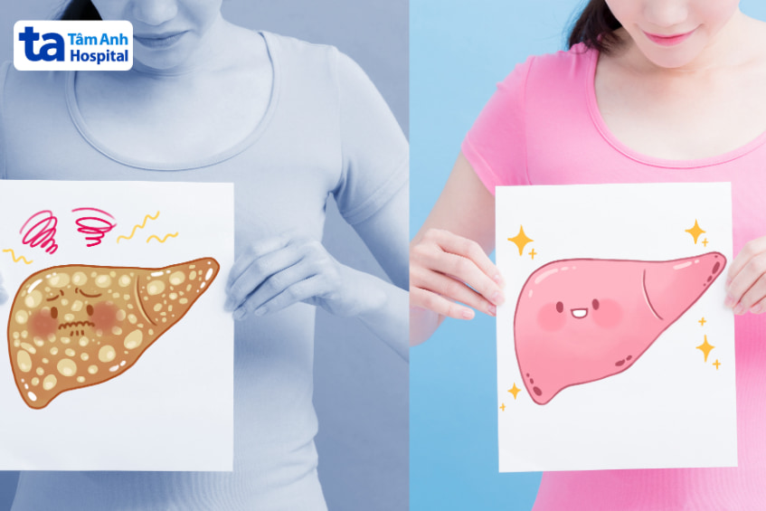 Những ai có thể uống nước dừa khi bị bệnh gan?