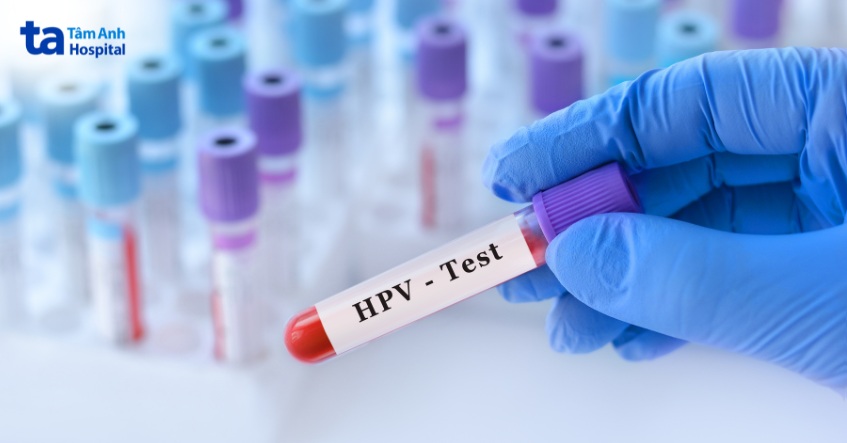 bệnh papilloma thanh quản