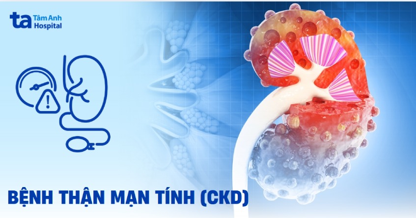 Bệnh thận mạn tính: Nguyên nhân, triệu chứng và cách phòng ngừa
