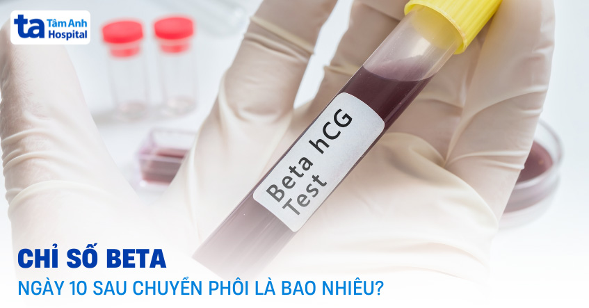 Beta ngày 10 sau chuyển phôi là bao nhiêu? Xét nghiệm được chưa?