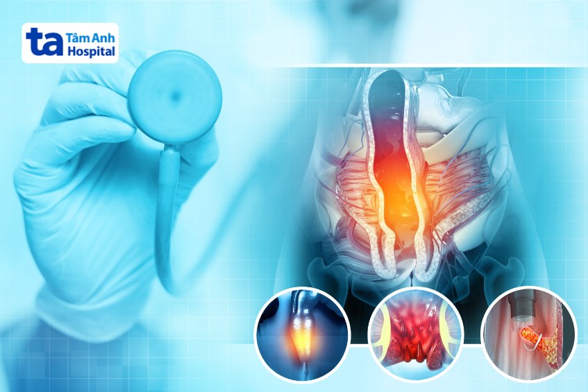 biến chứng bệnh trĩ