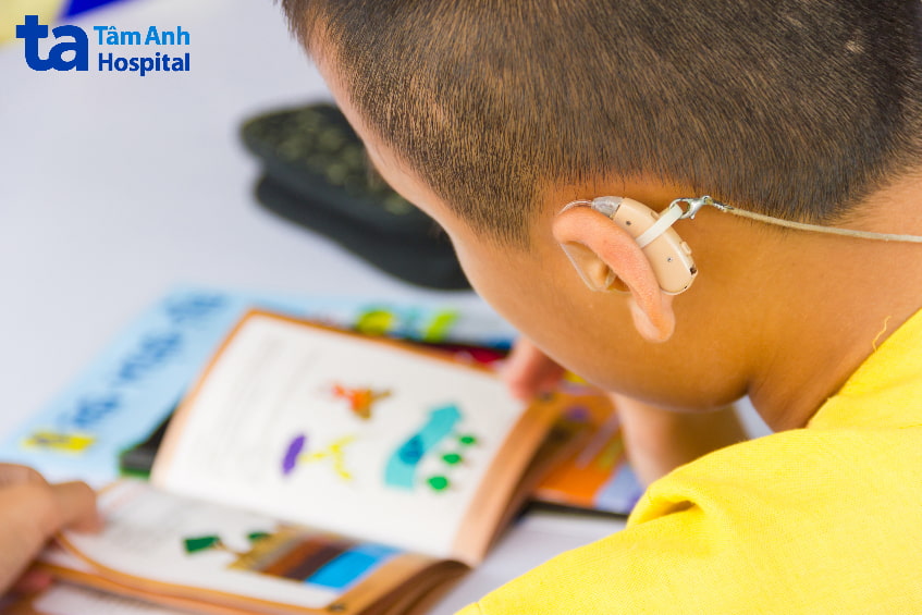 Hỗ trợ nghe nói cho người câm điếc bẩm sinh