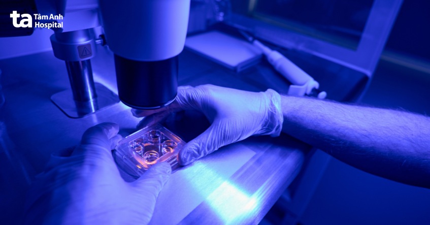 chẩn đoán papilloma thanh quản