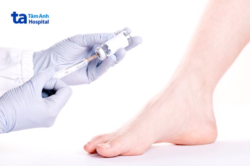 Chỉ định hút dịch khớp cổ chân