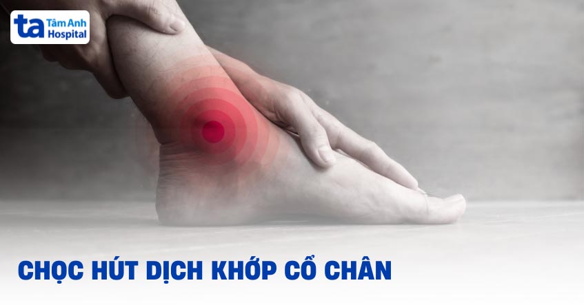 Chọc hút dịch khớp cổ chân là gì? Quy trình thực hiện thế nào?