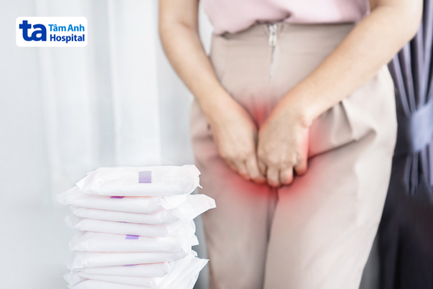 Chu kỳ kinh nguyệt của phụ nữ bị PCOS có thể kéo dài hơn bình thường