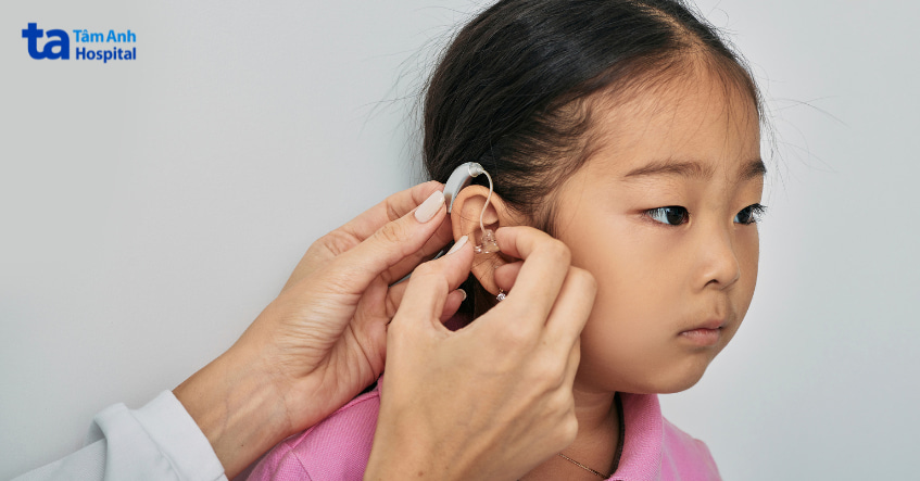 Cấy ghép tai giữa chữa điếc tai