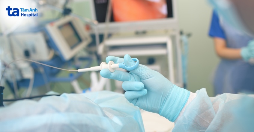 chữa papilloma thanh quản