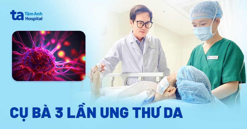 Cụ bà 3 lần ung thư da lòng bàn tay