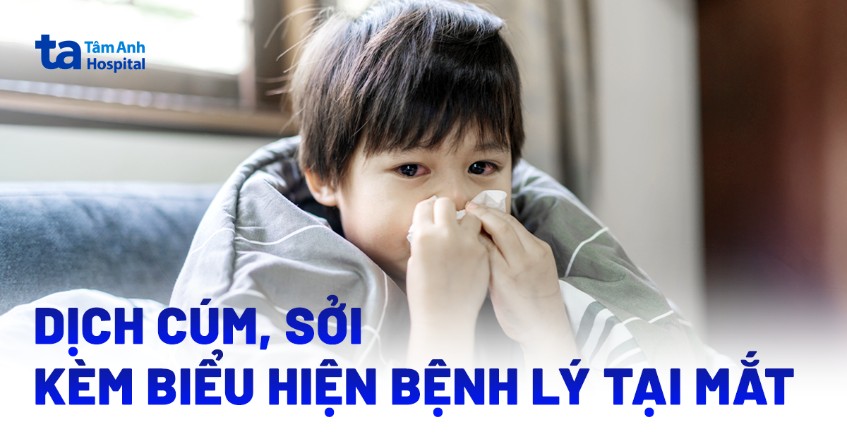cúm sởi kèm biểu hiện bệnh lý mắt