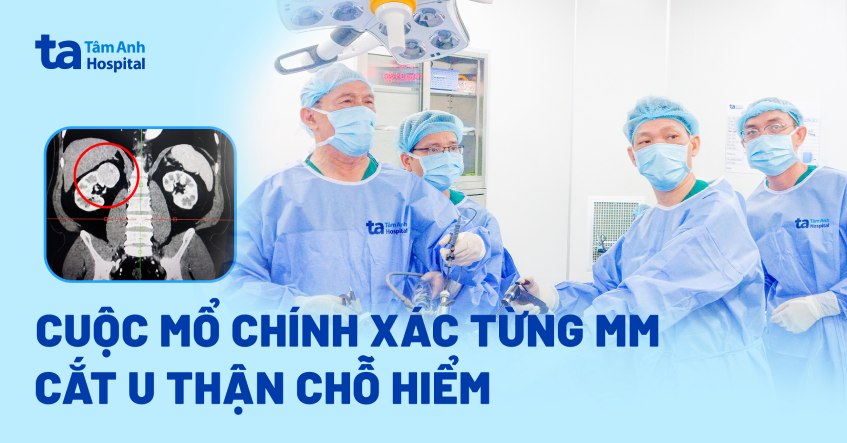 Cuộc mổ chính xác từng mm cắt u thận chỗ hiểm