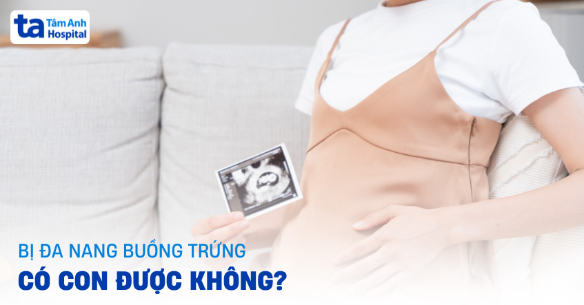 Đa nang buồng trứng có con được không? Khả năng tự nhiên có cao?