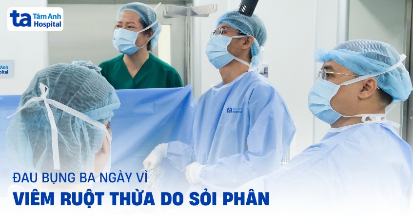 đau bụng ba ngày vì viêm ruột thừa do sỏi phân