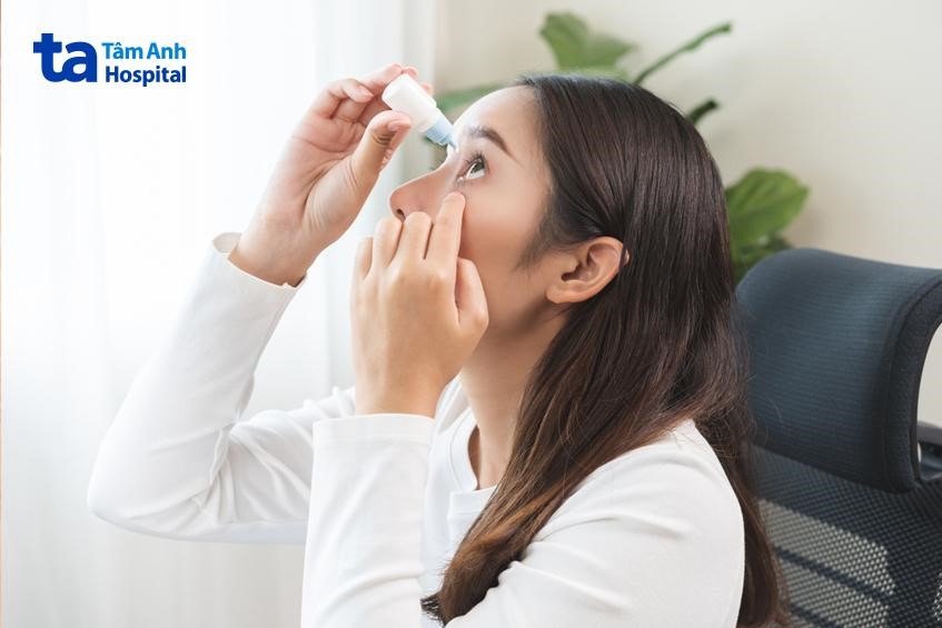 lưu ý khi điều trị bằng thuốc nhỏ mắt